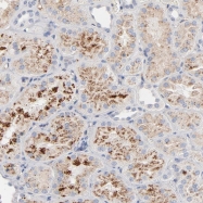 NBP1-87777 - Kallistatin / SERPINA4