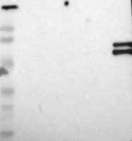 NBP1-87777 - Kallistatin / SERPINA4