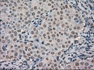 NBP1-47745 - FERMT2 / PLEKHC1