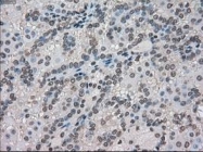 NBP1-47745 - FERMT2 / PLEKHC1