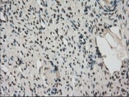 NBP1-47745 - FERMT2 / PLEKHC1