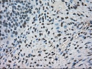 NBP1-47745 - FERMT2 / PLEKHC1