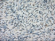NBP1-47745 - FERMT2 / PLEKHC1