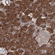 NBP1-87884 - FERMT2 / PLEKHC1