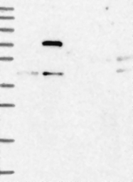 NBP1-87884 - FERMT2 / PLEKHC1
