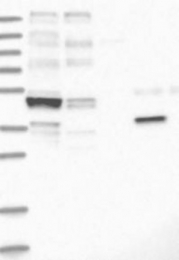 NBP1-87710 - KCNJ8