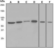NBP1-95299 - XRCC6 / Ku70
