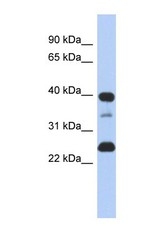 NBP1-59402 - TMPO / LAP2