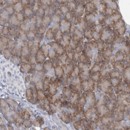 NBP1-86759 - Lebercilin