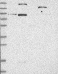 NBP1-86759 - Lebercilin