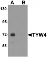NBP1-76585 - LCMT2