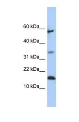 NBP1-57957 - Lipocalin-6