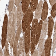 NBP1-82841 - Lipocalin-8