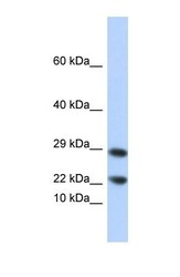 NBP1-56314 - Lipocalin-8