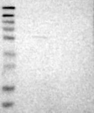 NBP1-85175 - LEMD2