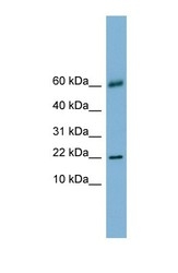 NBP1-57683 - Galectin-14