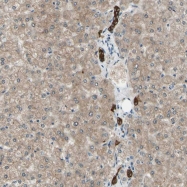 NBP1-83272 - LHPP