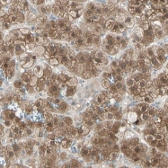 NBP1-83273 - LHPP