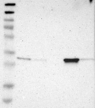 NBP1-83272 - LHPP