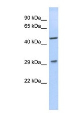 NBP1-56637 - LIX1