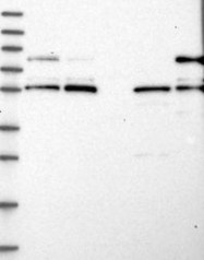 NBP1-82821 - LRCH4