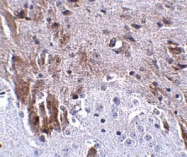NBP1-77345 - LRFN1