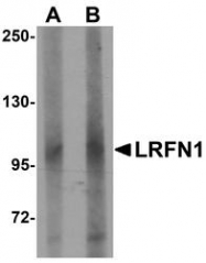 NBP1-77345 - LRFN1