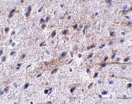 NBP1-77004 - LRFN5