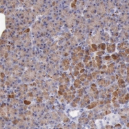 NBP1-88412 - LRFN5
