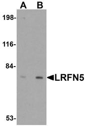 NBP1-77004 - LRFN5