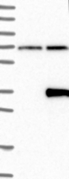 NBP1-89579 - LRRC3B / LRP15