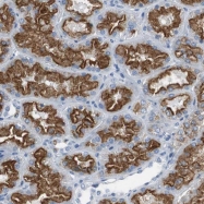NBP1-85292 - LRP2