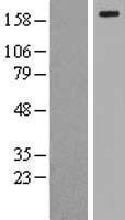 NBL1-12672 - LRP6 Lysate