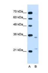 NBP1-69362 - LRPAP1 / A2MRAP