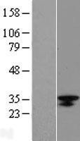 NBL1-12678 - LRRC18 Lysate