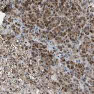 NBP1-93954 - LRRC19