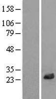 NBL1-12680 - LRRC20 Lysate