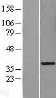 NBL1-12683 - LRRC28 Lysate
