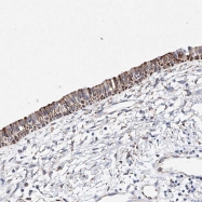 NBP1-90478 - LRRC33