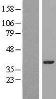 NBL1-12691 - LRRC39 Lysate