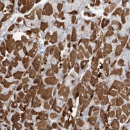 NBP1-92078 - LRRIQ3 / LRRC44