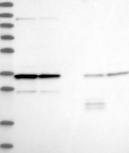NBP1-93953 - LRRC59