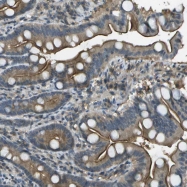 NBP1-91098 - LRRC66