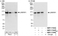 NBP1-71834 - LRRFIP1