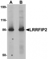 NBP1-76546 - LRRFIP2