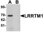 NBP1-76528 - LRRTM1