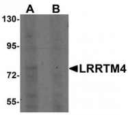 NBP1-76530 - LRRTM4