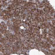 NBP1-85112 - LRWD1
