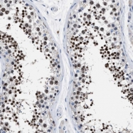 NBP1-85113 - LRWD1