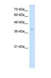 NBP1-59212 - LSAMP